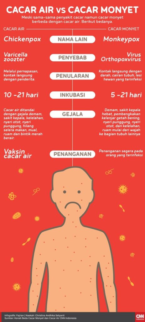 perbedaan cacar air dan cacar monyet | sumber: CNN Indonesia