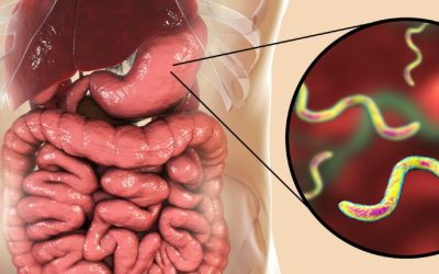 Mengenal Bakteri Pylori: Penyebab Utama Gangguan Lambung